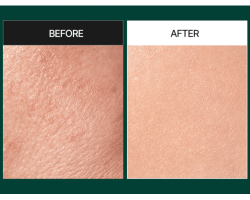 Sérum exfoliante suave con espículas y centella MEDIPEEL Phyto Cica-Nol B5 3000 Shot Serum 50 ml