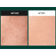 Sérum exfoliante suave con espículas y centella MEDIPEEL Phyto Cica-Nol B5 3000 Shot Serum 50 ml
