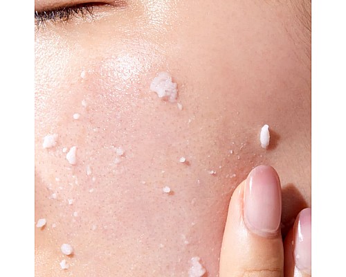 Gel Peeling Calmante con Vitaminas MEDIPEEL Phyto Cica-Nol B5 AHA BHA 120 ml