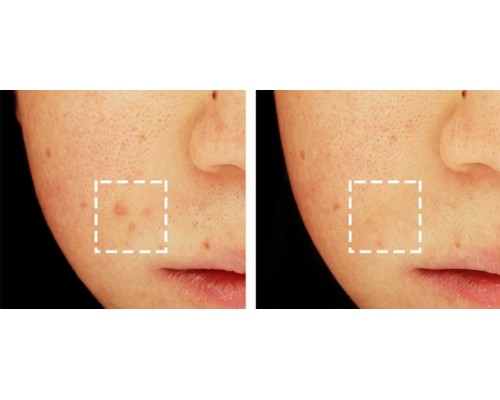Medi-Peel Cica-Nol — Gel limpiador calmante y refrescante 30 ml